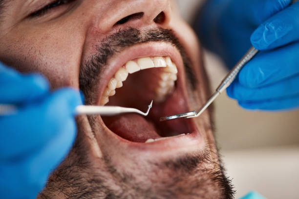 Best Broken or Cracked Tooth Emergency Dentist in La Grange, NC