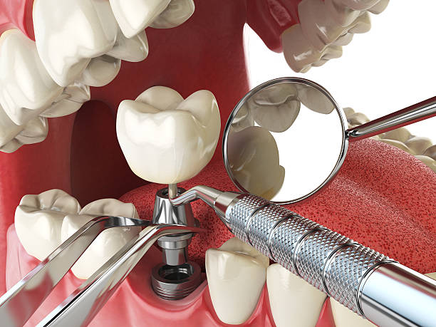 Best Emergency Dental Extractions in La Grange, NC
